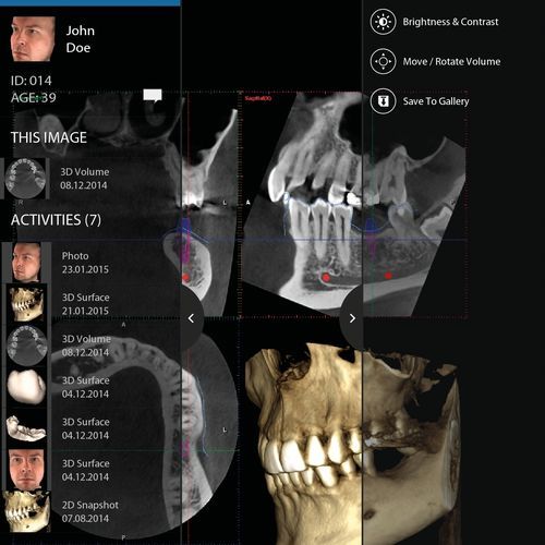 牙科iOS应用程序 - mRomexis™ - Planmeca/普兰梅卡 - 用于牙科造影 / 临床 / 可视化
